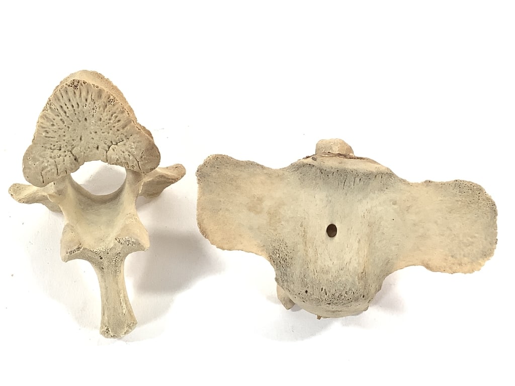 Nice 5 Pc Vertebrae Collection - 10