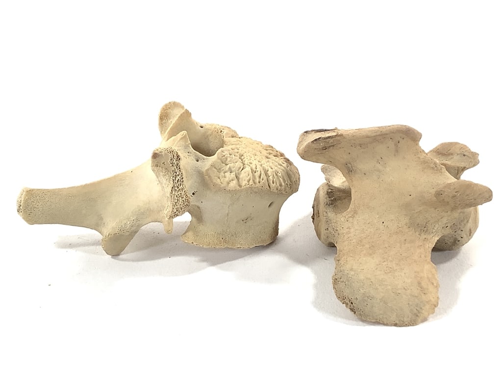 Nice 5 Pc Vertebrae Collection - 11