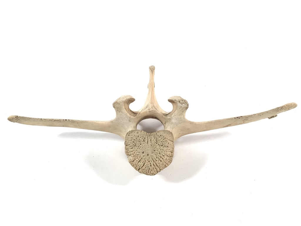 Nice 5 Pc Vertebrae Collection - 4