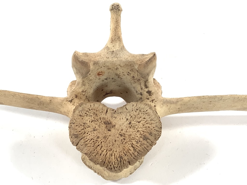Nice 5 Pc Vertebrae Collection - 5
