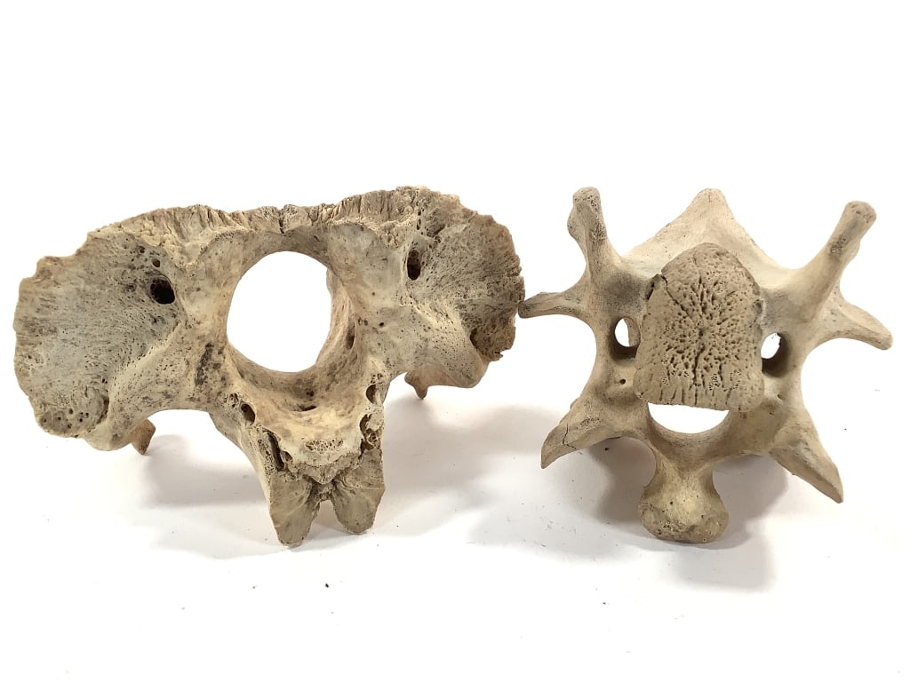 Nice 5 Pc Vertebrae Collection - 7