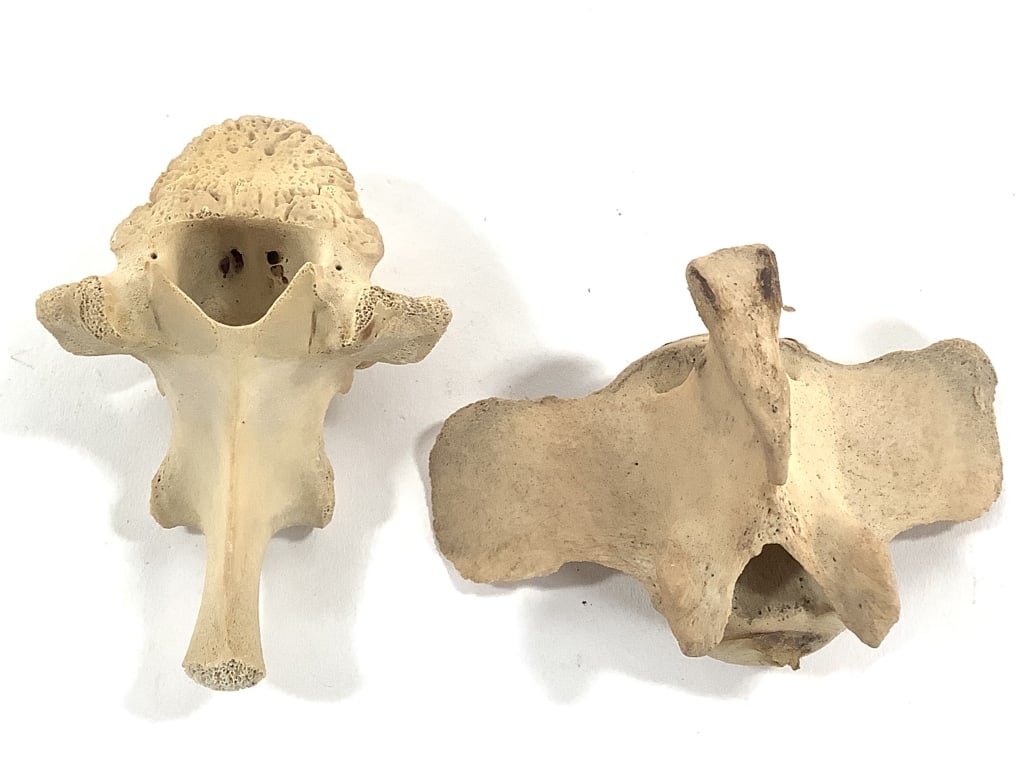 Nice 5 Pc Vertebrae Collection - 9