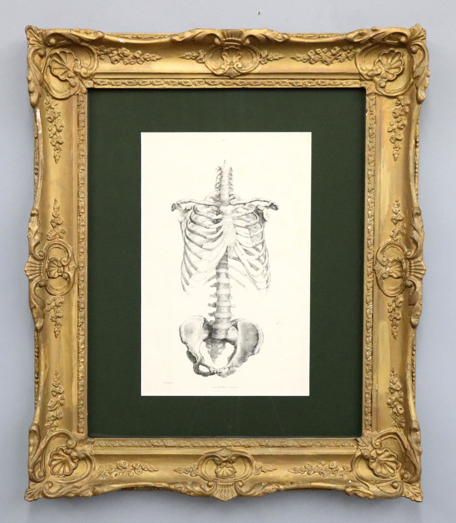 W. Fairland Anatomical Lithograph (1 of 2)